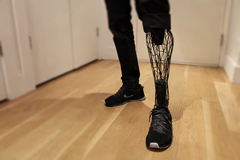 3D printed Exo-Prosthetic leg. Source: <b>New Atlas</b>